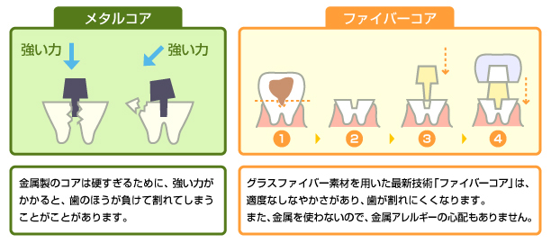 歯に対するダメージ